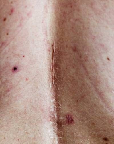 cicatriz e1748991391456